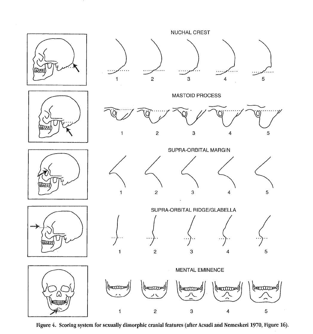 Standards for data collection from human skeletal remains (Seminar), In Buikstra, J. E., & In Ubelaker, D. H. (1993). Standards for data collection from human skeletal remains. Arkansas Archeological Survey.